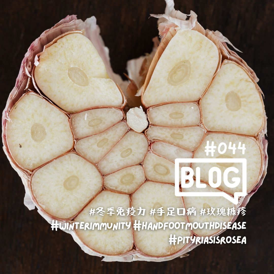 WeLoveBlog #044: When Your Skin Sends a Signal – Navigating Winter Immunity Through Hand, Foot, and Mouth Disease & Pityriasis Rosea